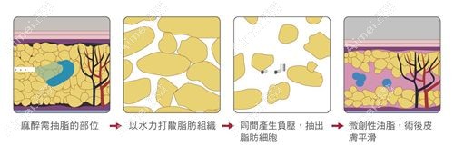 太原军大整形医院吸脂价格查询m.dlren.com.jpg