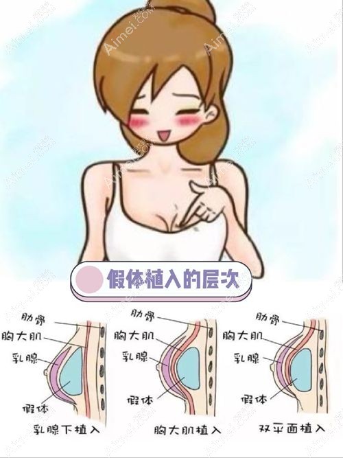 太原军大整形医院隆胸价格查询www.dlren.com.jpg