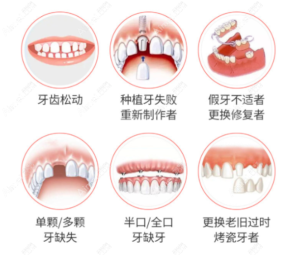 宜春名星种植牙怎么样aimei.com