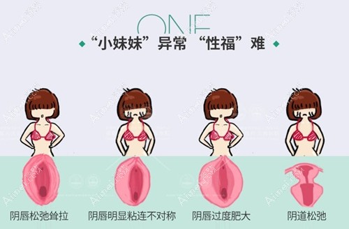 做完紧缩手术后悔死了咋办,说说做完激光缩阴之后真实感受