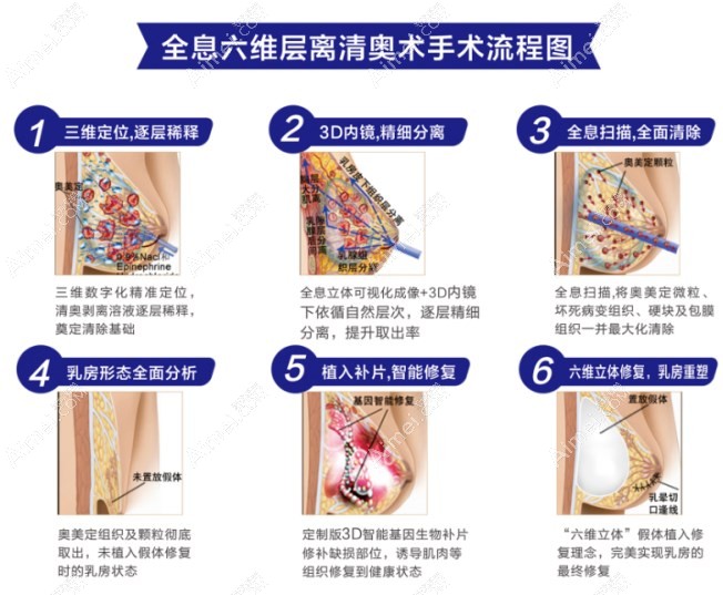 齐云香取注射物怎么样?取奥美定和生长因子技术好,名气大