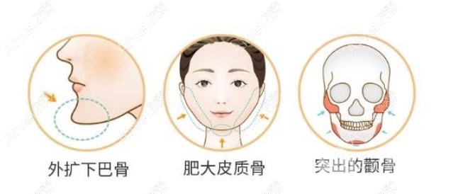 国内十大磨骨医生是谁www.dlren.com 国内十大磨骨医生是谁www.dlren.com