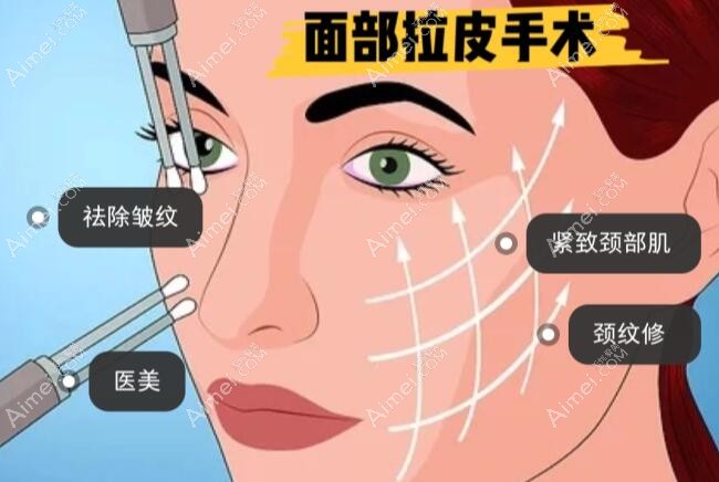 探究v美减龄面部提升是真是假？做过的人都这么评价