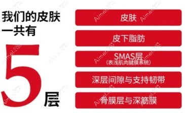 v美减龄面部提升提拉层次图解 v美减龄面部提升提拉层次图解