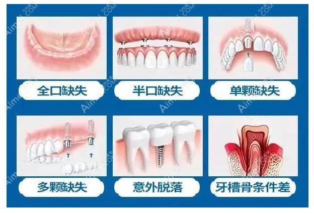 重庆牙博士口腔医院李荣医生种植牙怎么样