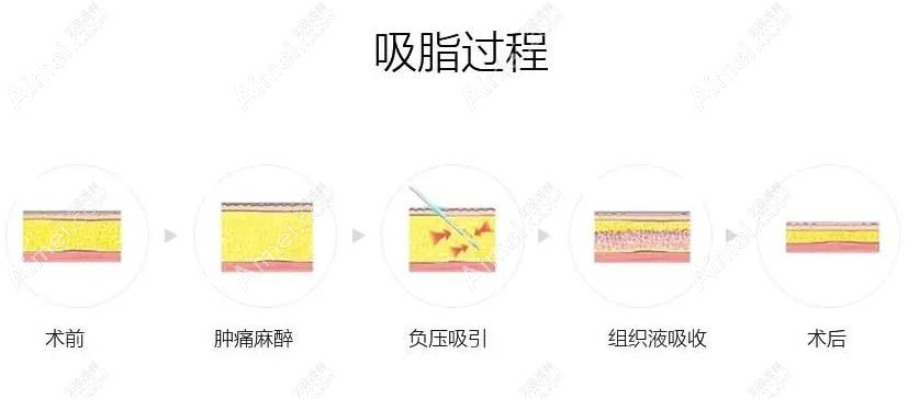 常州多美整形资质价格 常州多美整形资质价格