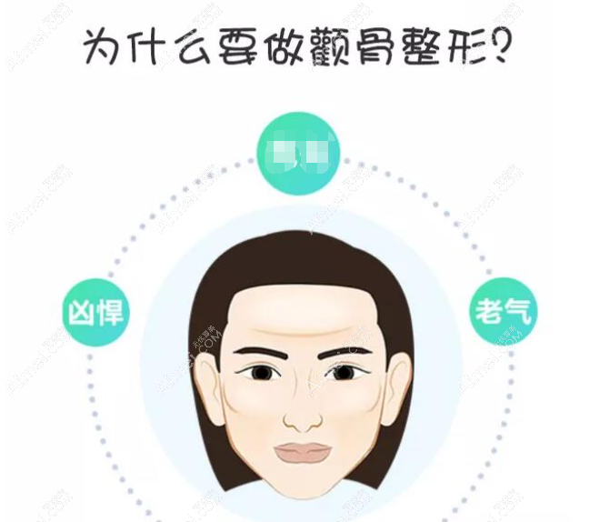 颧骨颧弓推多了怎么修复