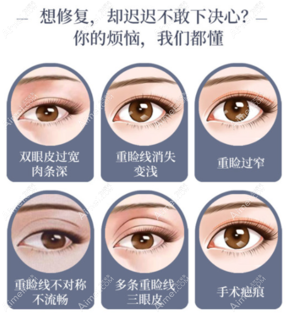 黄泽春双眼皮修复评价 黄泽春双眼皮修复评价