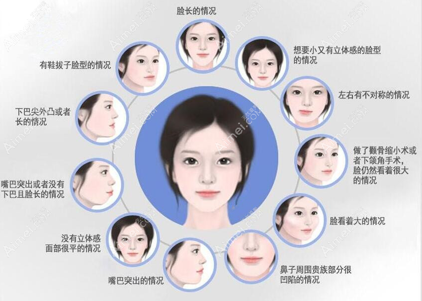 韩国全脸磨骨手术部位 韩国全脸磨骨手术部位