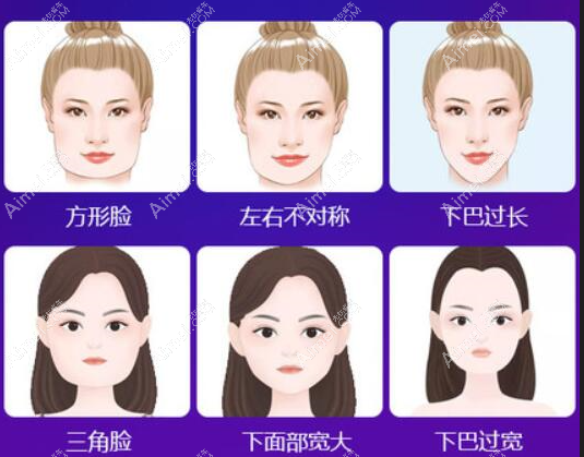 整容改脸型要多少钱?国内改脸型3-10万,比韩国全脸整容便宜