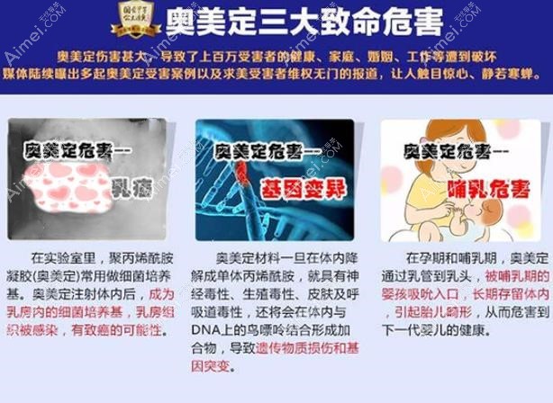 英捷尔法勒隆胸后遗症有哪些 爱美网 英捷尔法勒隆胸后遗症有哪些 爱美网