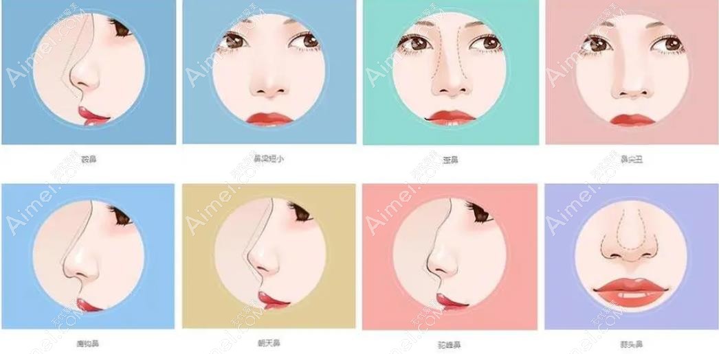 刘彦军做鼻子多少钱起步www.dlren.com 刘彦军做鼻子多少钱起步www.dlren.com