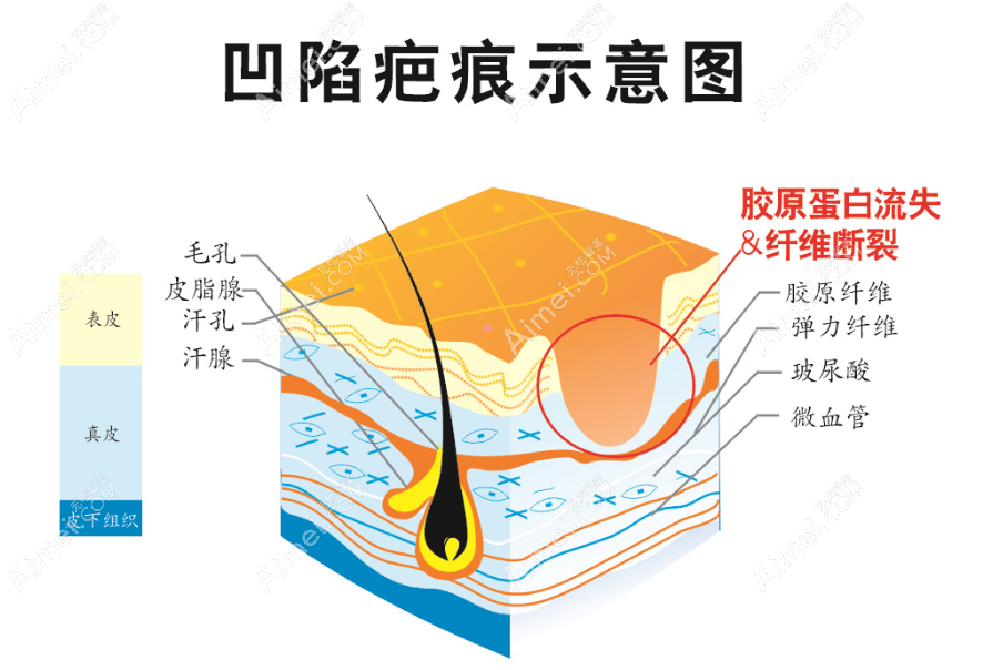 成都友谊医院疤痕科是成都出名的疤痕医院 成都友谊医院疤痕科是成都出名的疤痕医院
