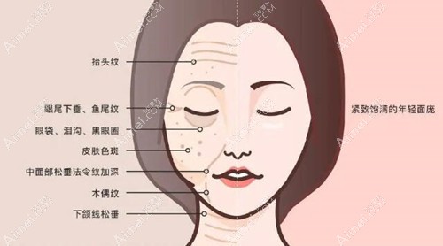 深圳做拉皮手术好的医院 深圳做拉皮手术好的医院