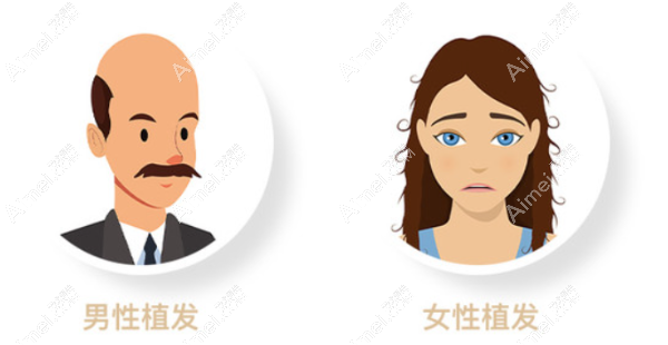 广州植发医院哪家好 广州植发医院哪家好