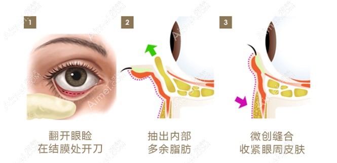 深圳健丽医美地址 深圳健丽医美地址