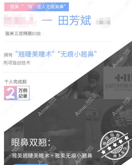 田芳斌做双眼皮怎么样m.dlren.com 田芳斌做双眼皮怎么样m.dlren.com