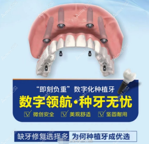 沈阳米兰口腔种植牙怎么样aimei.com 沈阳米兰口腔种植牙怎么样aimei.com