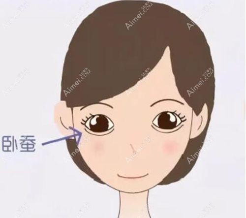 韩国卧蚕手术好的医院推荐promise,玻尿酸丰卧蚕自然价格不贵