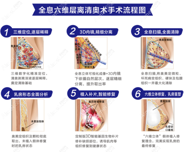 广州荔湾全息六维层离清奥术过程dlren.com 广州荔湾全息六维层离清奥术过程dlren.com