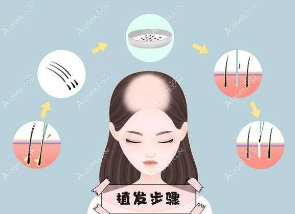 济南海峡植发怎么样www.dlren.com