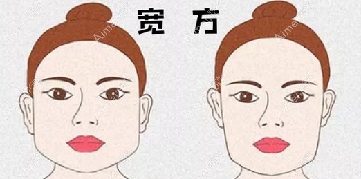 成都磨骨三件套多少钱?下颌角+颧骨5.6万起,附预约方式