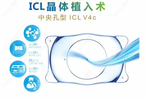 人工晶体品牌价格表:人工晶体十大排名中进口的比国产贵6000
