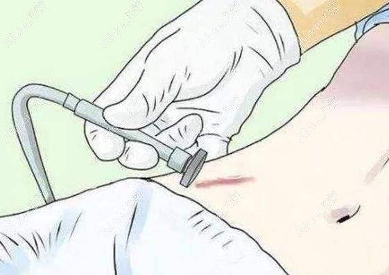 深圳祛疤有名的医院排名www.dlren.com 深圳祛疤有名的医院排名www.dlren.com