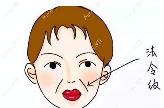 v美减龄面部提升坚持时间 v美减龄面部提升坚持时间