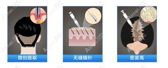 厦门万禾丽生植发植发优势