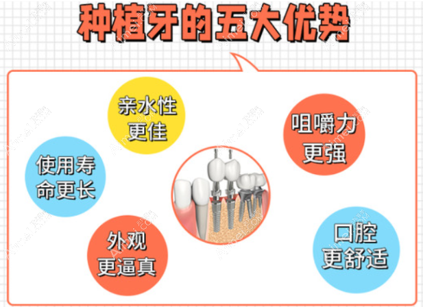 老人做种植牙好还是活动假牙好 老人做种植牙好还是活动假牙好