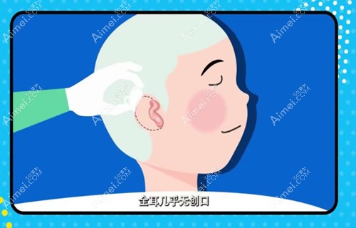 耳再造和真耳差别大吗?他外耳再造为什么比健侧耳大?