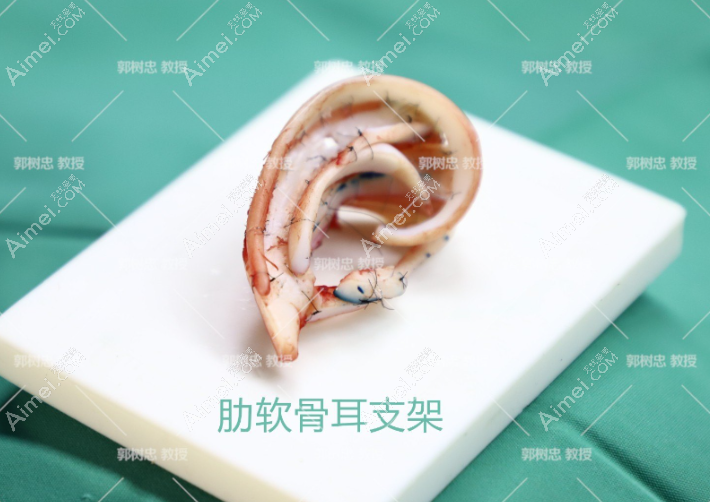 郭树忠耳再造价格50000元~160000元 郭树忠耳再造价格50000元~160000元