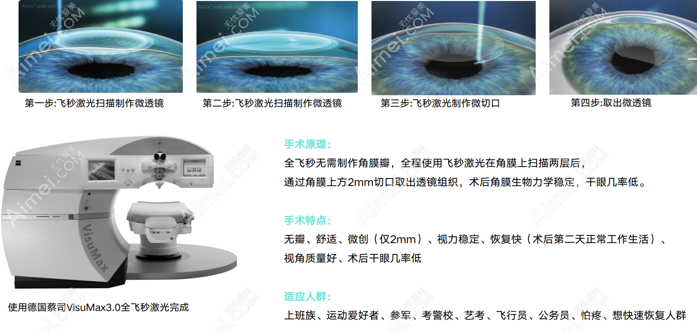 西安市全飞秒近视手术14800元起 西安市全飞秒近视手术14800元起