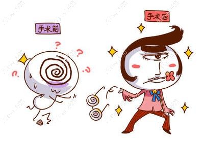 prk手术和全飞秒手术哪个好 prk手术和全飞秒手术哪个好