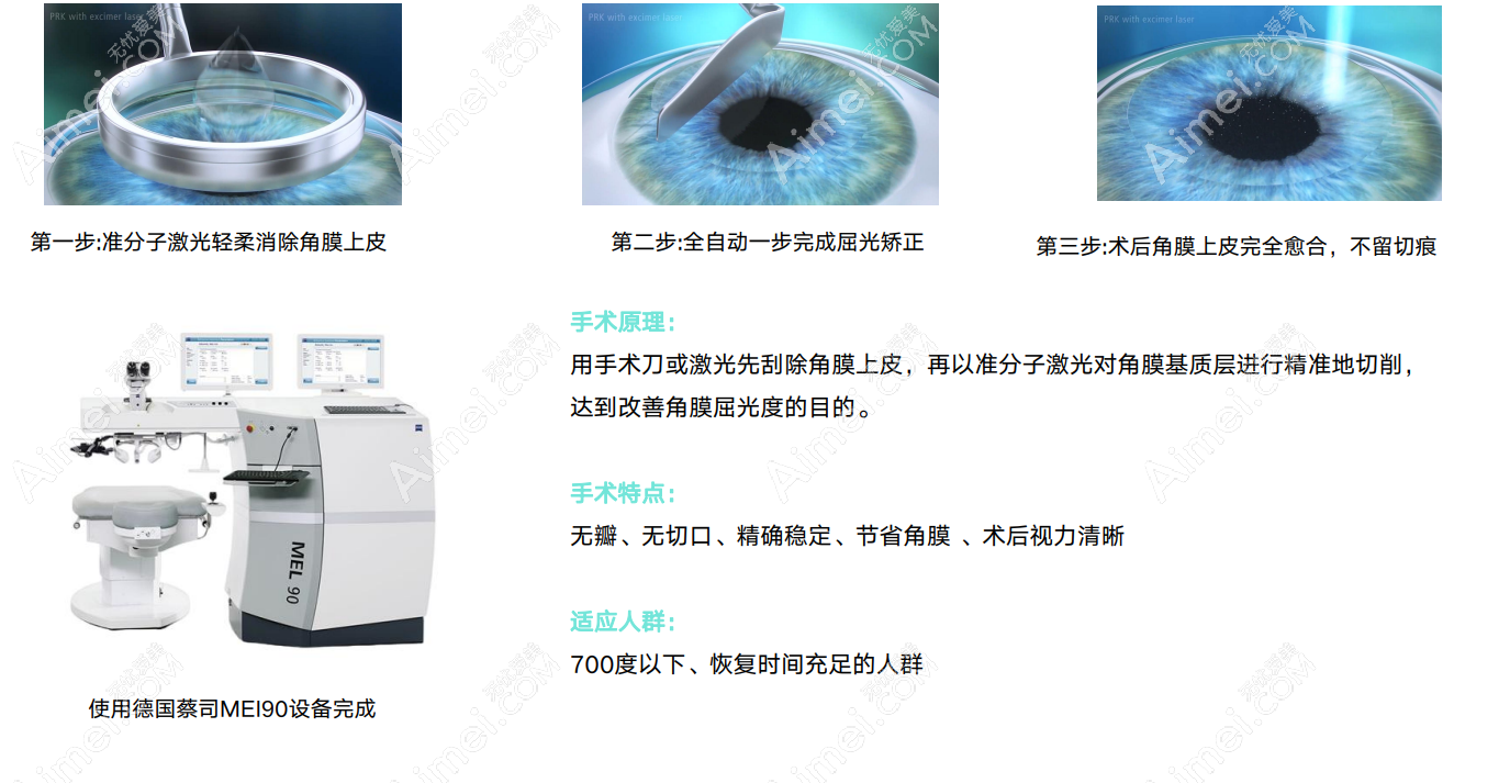 西安激光近视手术价格8800元起 西安激光近视手术价格8800元起