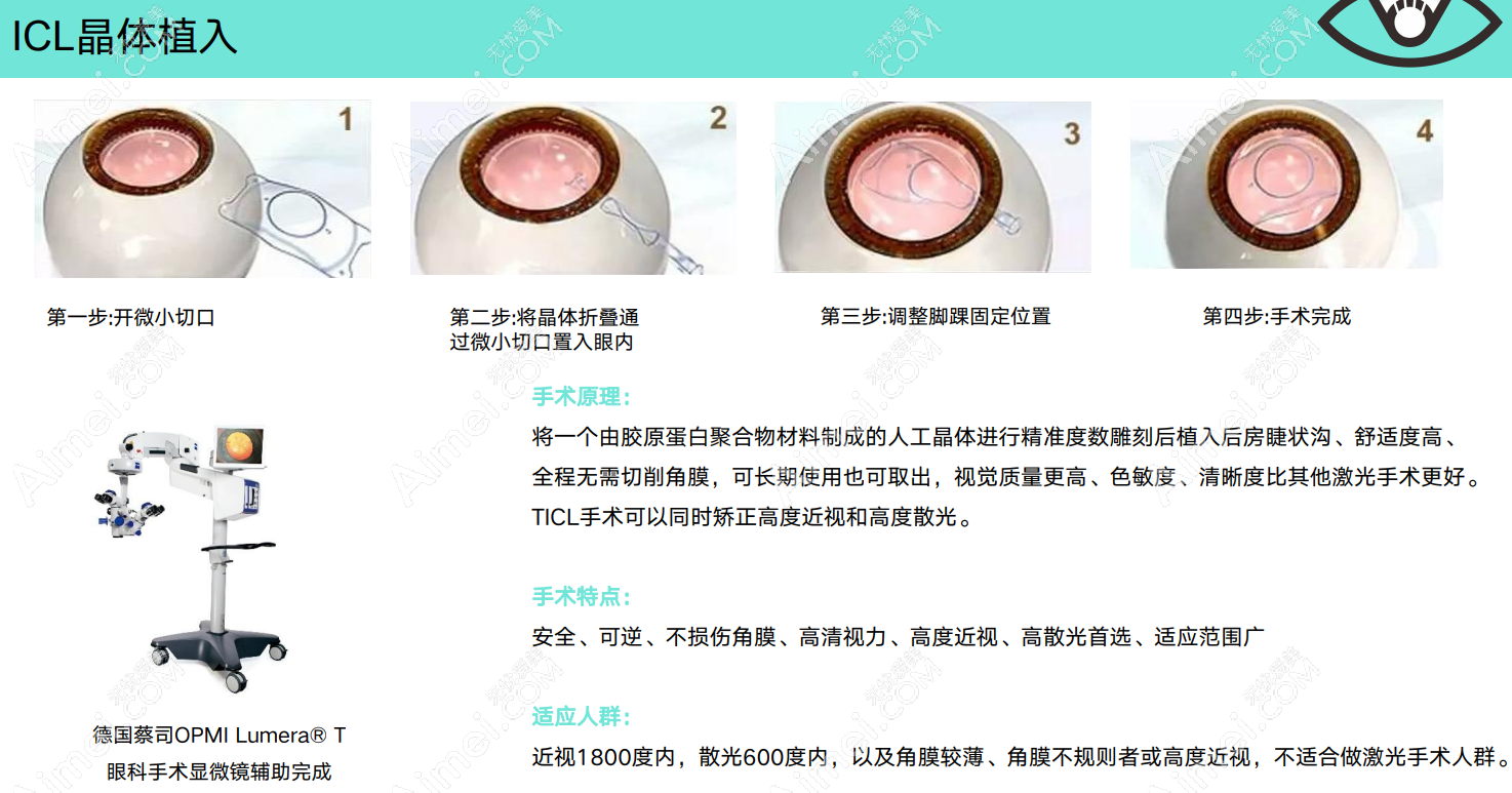 西安晶体植入近视手术31800元起 西安晶体植入近视手术31800元起