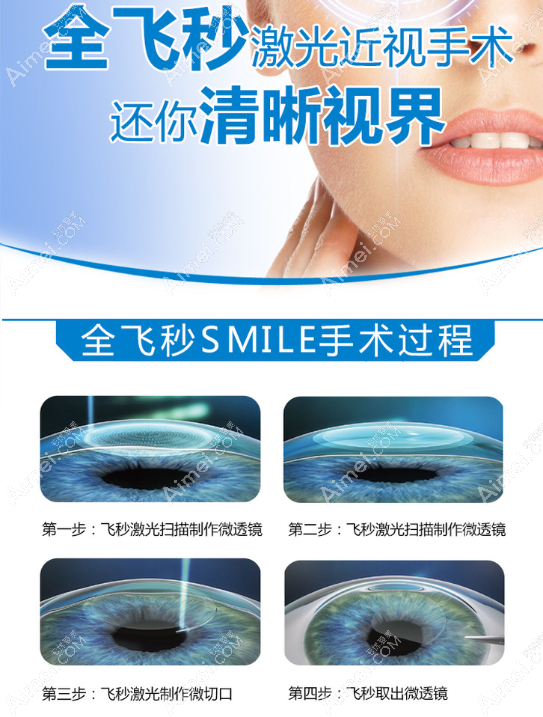 西安市全飞秒近视手术过程 西安市全飞秒近视手术过程