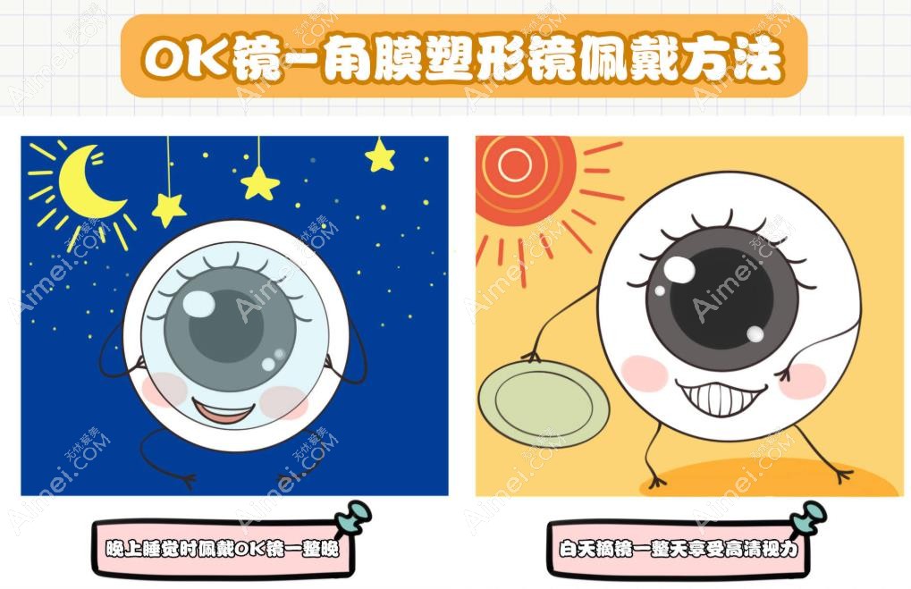 角膜塑形镜不一定能控制近视