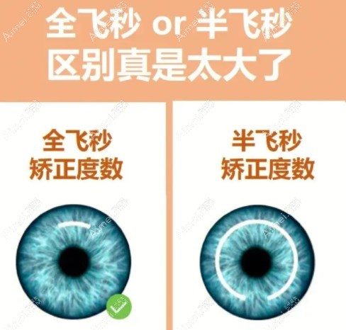 近视全飞秒和半飞秒手术的价格区别m.aim#ei.com 近视全飞秒和半飞秒手术的价格区别m.aim#ei.com