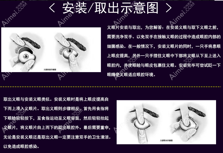 义眼的安装和佩戴 义眼的安装和佩戴