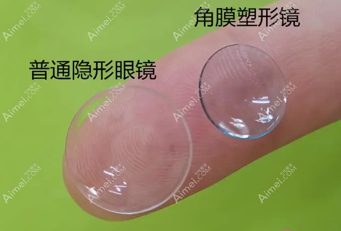 OK镜集采是什么意思 OK镜集采是什么意思