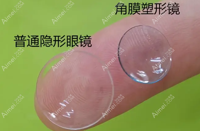 角膜塑形镜 角膜塑形镜