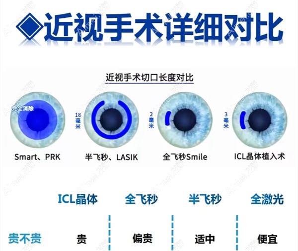 昆明眼科医院做近视眼手术的价格 昆明眼科医院做近视眼手术的价格