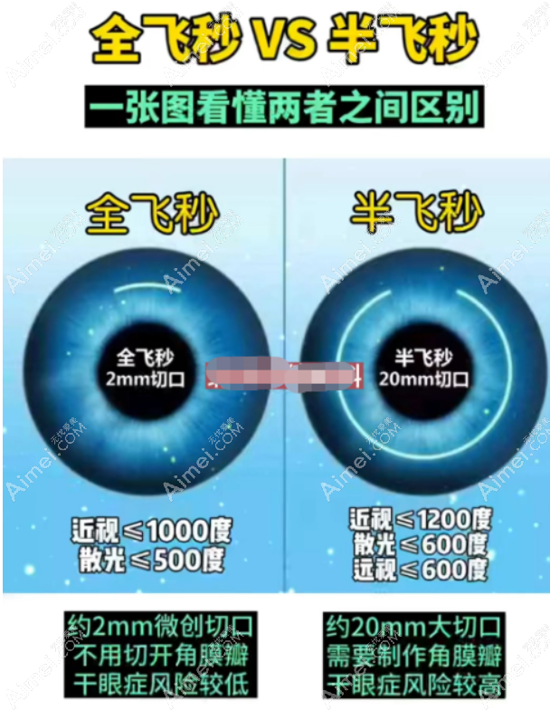 全飞秒和半飞秒近视眼手术区别 全飞秒和半飞秒近视眼手术区别