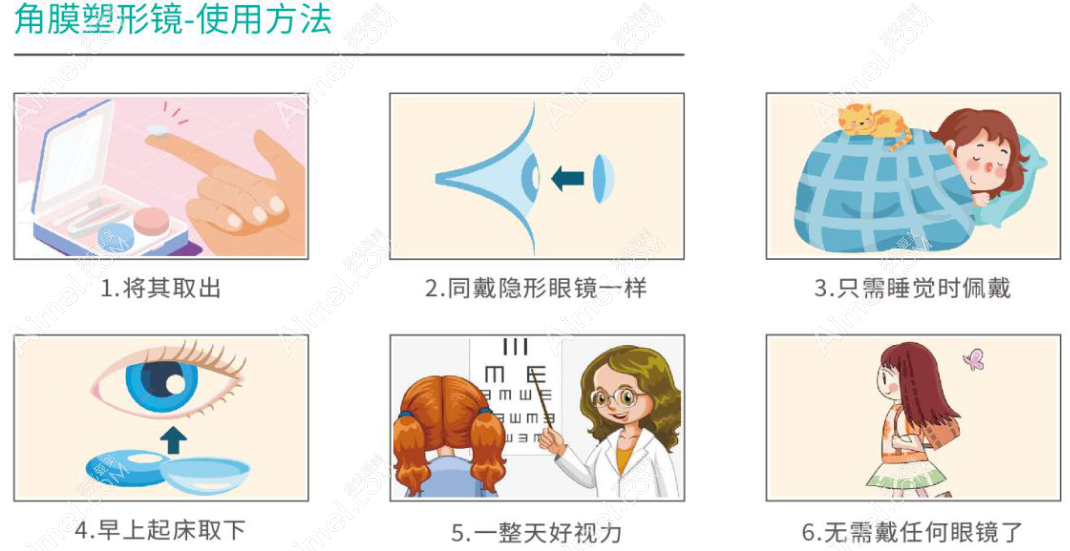 角膜塑形镜佩戴方法 角膜塑形镜佩戴方法