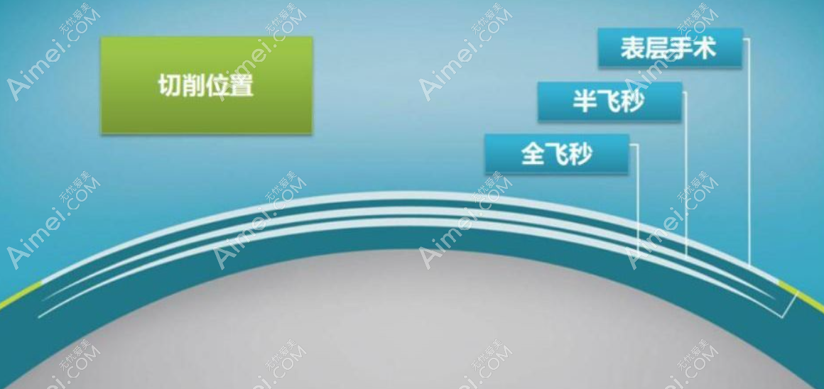 昆明眼科医院全飞秒和半飞秒激光切削位置区别 昆明眼科医院全飞秒和半飞秒激光切削位置区别