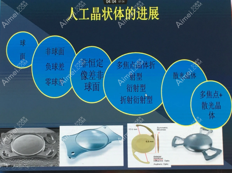 人工晶状体降价啦！集采后近视手术晶体植入价格降至千元
