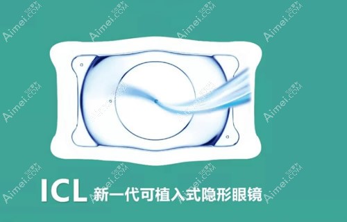 icl晶体移位概率大吗?icl晶体移位怎么补救,需要另行收费吗