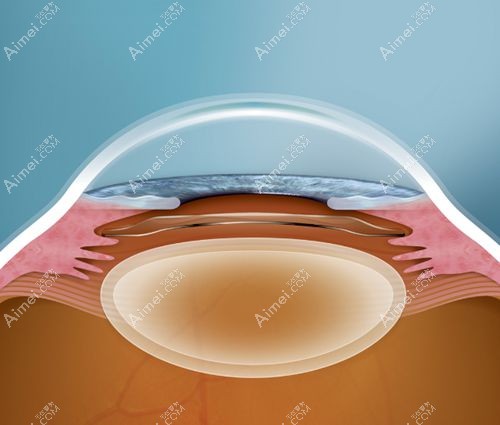 icl第六代晶体国内不能做m.dlren.com icl第六代晶体国内不能做m.dlren.com